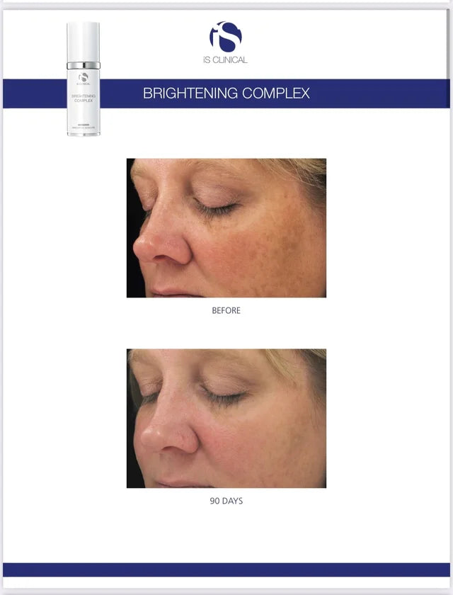 Brightening Complex | Beauty Matters