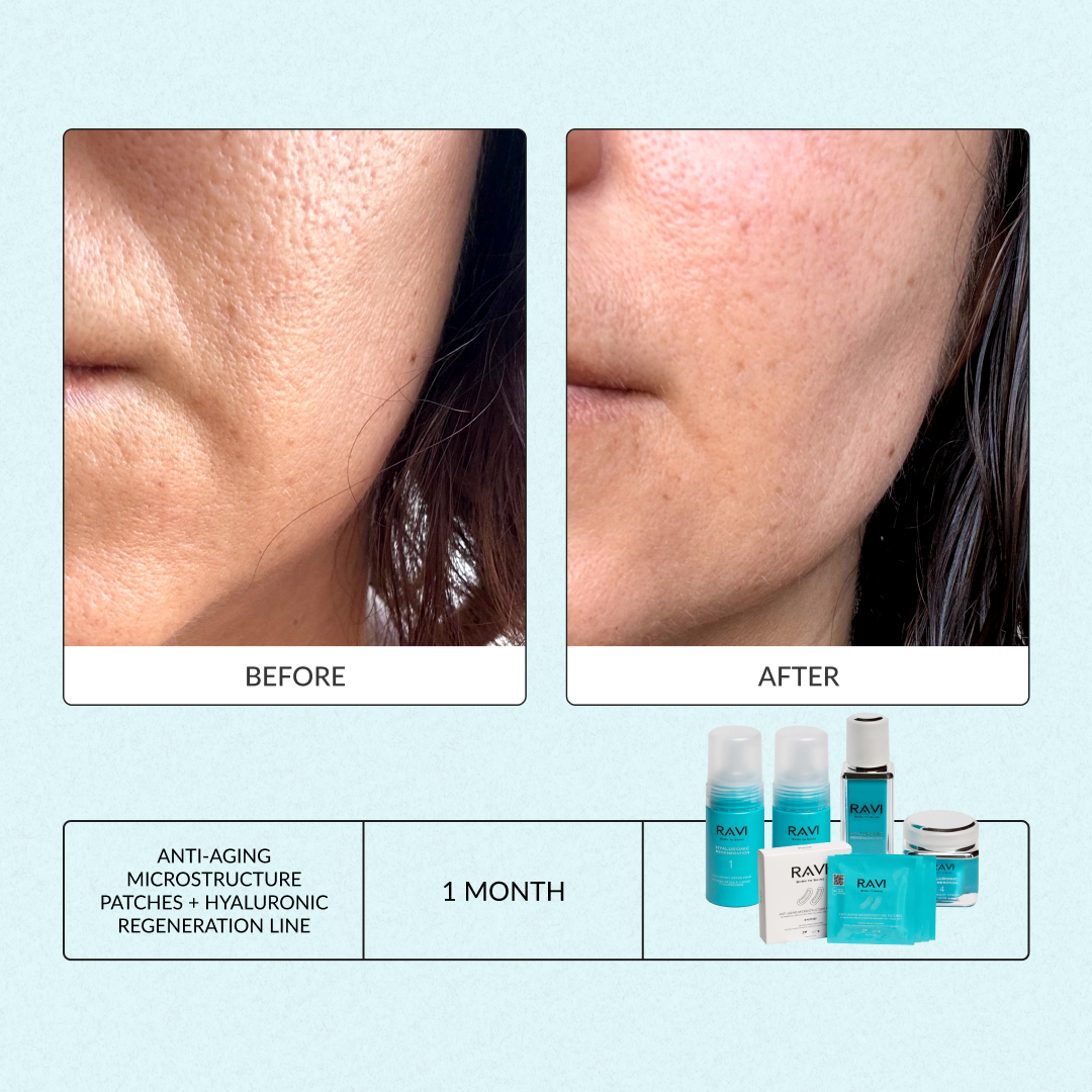 Hyaluronic Regeneration Day & Night Serum | Beauty Matters