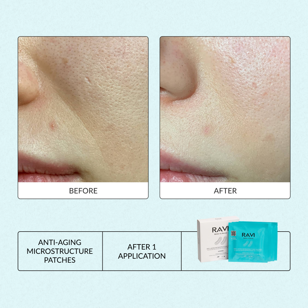 Anti-Aging Microstructure Patches | Beauty Matters